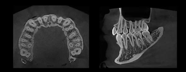 HDX Will Performance Radiology | Dentri Max 16x18 Panoramic | PR.NDA30.100.01.00 - Image 2